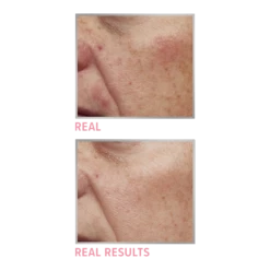 IT Cosmetics Bye Bye Redness Neutralizing Color-Correcting Concealer Cream