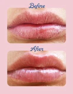 Green Apple 101 Ointment Multi-Balm