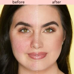 Skin Treat Vegan Stick Concealer