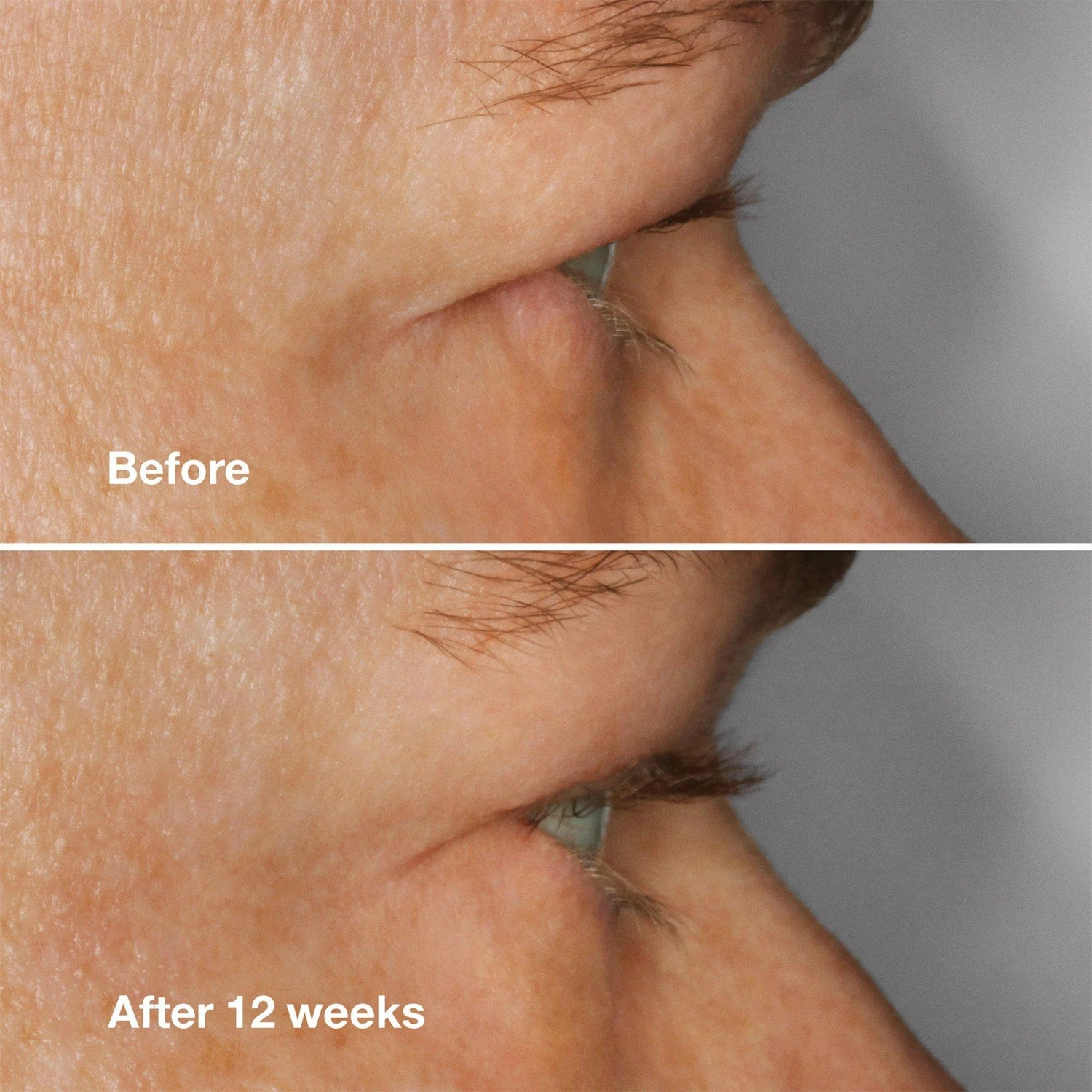 Clinique High Impact Lash Amplifying Serum 5 Clinique High Impact Lash Amplifying Serum - Image 5