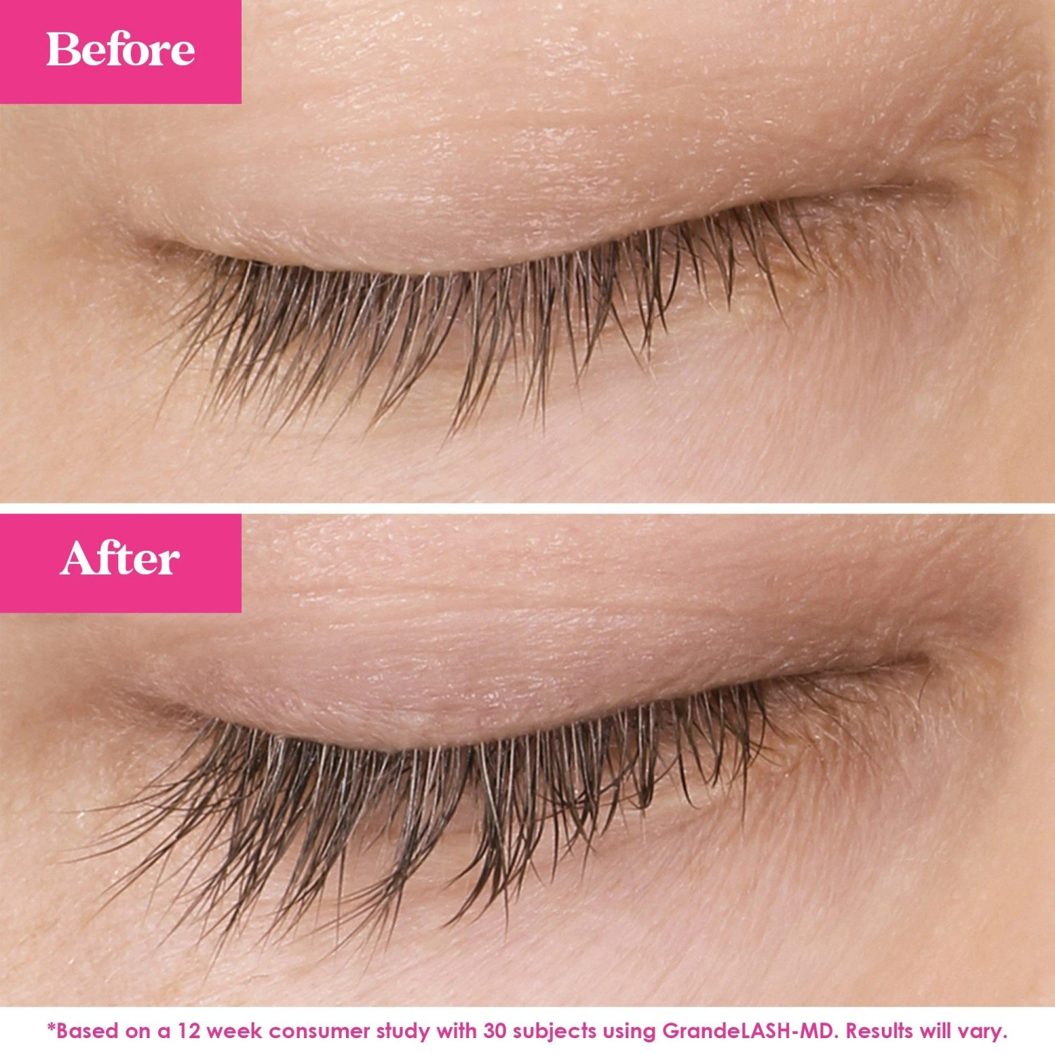 Lash Fix-It Starter Kit 5 Lash Fix-It Starter Kit - Image 5