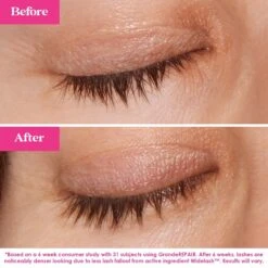 Lash Fix-It Starter Kit 6 Lash Fix-It Starter Kit -Outlet Rosmiral Store 2592910cm alt04