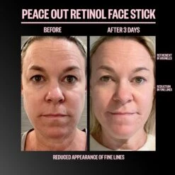 Retinol Face Stick -Outlet Rosmiral Store 2607968 alt05