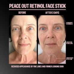 Retinol Face Stick -Outlet Rosmiral Store 2607968 alt06